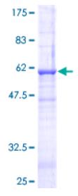 SDS-PAGE (FASLG-3857H).jpg